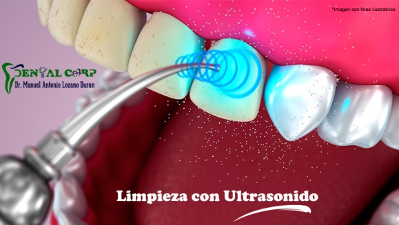 [Imagen:¡Paga $25 en Lugar de $180 por 3 Rellenos de Resina o 4 Sellantes + Radiografía + Limpieza Dental con Ultrasonido + Aplicación de Flúor + Consulta y Diagnóstico Bucodental con Cámara Intraoral + Evaluación de Cordales!]