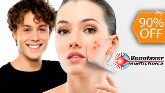 [Imagen:¡Paga $99 en lugar de $950 por 4 Sesiones de Láser Anti-Acné + 4 Faciales en Venolaser!]