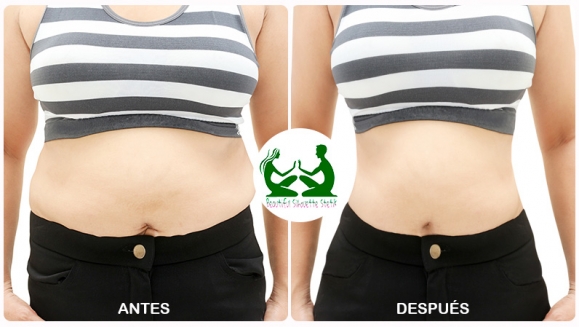 [Imagen:¡Paga Q299 en lugar de Q5,900 por Liposucción sin Cirugía de 120 tratamientos: 30 Mesoterapias + 20 Masajes Escultores + 10 Ultracavitaciones + 10 Lipoláser + 20 Electroterapias + 10 Vendas Termoactivas + 10 Vibroterapias + 10 Detox y Más!]
