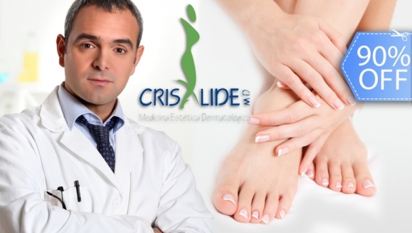 [Imagen:¡Acaba YA con Los Hongos de las Uñas! ¡Paga Q95 en lugar de Q950 por Tratamiento Láser para Hongos en 1 Uña + Examen Diagnóstico en Crisalide!]