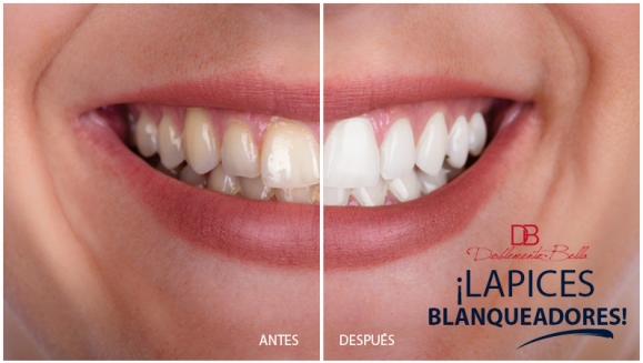[Imagen:¡Paga Q130 en Lugar de Q285 por 3 Lápices Blanqueadores de Dientes!]