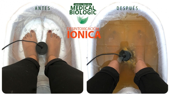[Imagen:¡Paga $10 en Lugar de $20 por 2 Sesiones de Desintoxicación Iónica + Análisis de Resultados!]