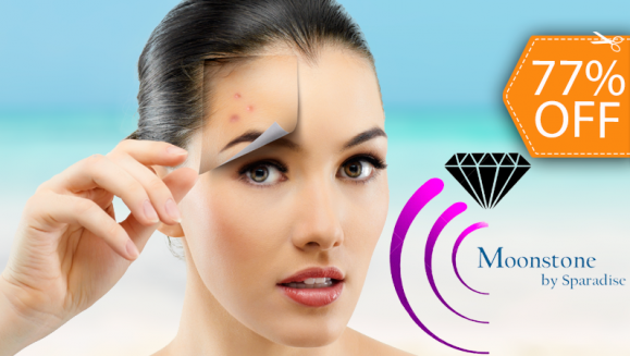 [Imagen:¡Paga $22 en lugar de $95 por 2 Microdermoabrasiones con Punta de Diamante + 2 Limpiezas Faciales Profundas + 2 Vaporizaciones + 2 Extracciones de Puntos Negros + 2 Altafrecuencias + 2 Aplicaciones de Velo de Colágeno en Moonstone by Sparadise!]