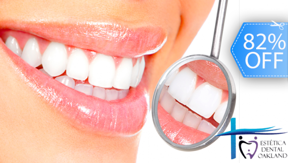 [Imagen:¡Paga Q259 en lugar de Q1,450 por Paquete Dental con: 2 Rellenos o 4 Sellantes + Limpieza con Ultrasonido + Pulido Dental con Profijet + Aplicación de Fluor + 2 Radiografías + Exámen Diagnóstico con Cámara Intraoral en Estética Dental Oakland!]