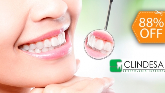 [Imagen:¡Paga $25 en lugar de $200 por 3 Rellenos de Resina Blanca o 5 Sellantes + Diagnóstico en Cámara Intraoral + 2 Limpieza con Ultrasonido + 2 Aplicaciones de Flúor en Clínicas Clindesa!]