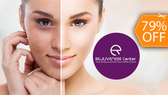 [Imagen:¡Paga $30 en vez de $140 por Paquete Facial que Incluye: 3 Peeling de Ácido Láctico y Ácido Glicólico + 3 Mascarillas de Colágeno + Evaluación Profesional de la Piel y Más en Rejuveness Center!]