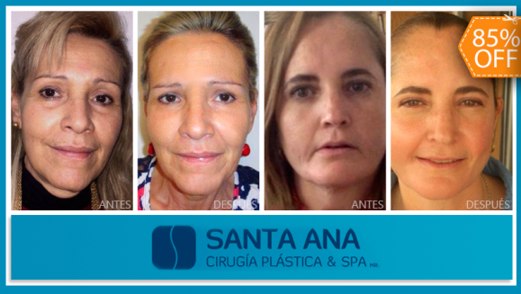 [Imagen:¡Paga $200 en lugar de $1,350 por 3 Sesiones de Plasma Rico en Plaquetas para Rejuvenecimiento del Rostro en Santa Ana Cirugía Plástica &amp; Spa!]