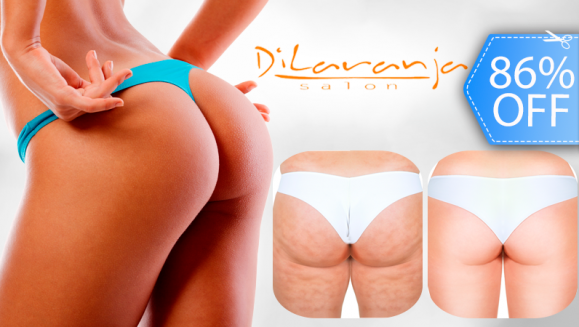 [Imagen:¡Paga Q375 en lugar de Q2,700 por Exclusiva Sesión de Plasma Rico en Plaquetas para Reducción y Tratamiento de Celulitis en Piernas o Glúteos + Evaluación Médica por Cirujano Plástico + Examen de Hematología + Consulta Post Tratamiento en Dilaranja!]