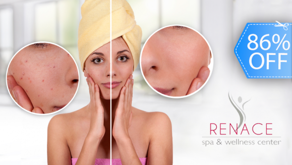 [Imagen:¡Paga Q99 en lugar Q700 por Facial Anti-Acné que Incluye: Limpieza Facial + 1 Microdermoabrasión + Vaporización + Altafrecuencia + Energía Galvánica + Mascarilla de Olivo + Exfoliante + Extracción de Puntos Negros en Renace Spa!]