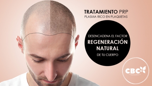 [Imagen:¡Paga $199 en Lugar de $740 por 3 Sesiones de Plasma Rico en Plaquetas para Calvicie o Rejuvenecimiento Facial + 3 Limpiezas de Rostro + 3 Mascarillas de Ozono o Carbón Activado + 3 Microneedling + 6 Mascarillas Vampiro con Colágeno Puro y Más!]