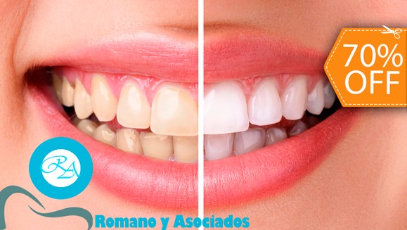 [Imagen:¡Paga $70 en lugar de $237 por Blanqueamiento Dental con Sistema Zoom + Limpieza con Ultrasonido + Diagnóstico con Cámara Intraoral + Revisión de Cordales en Clínica Médica Romano y Asociados!]