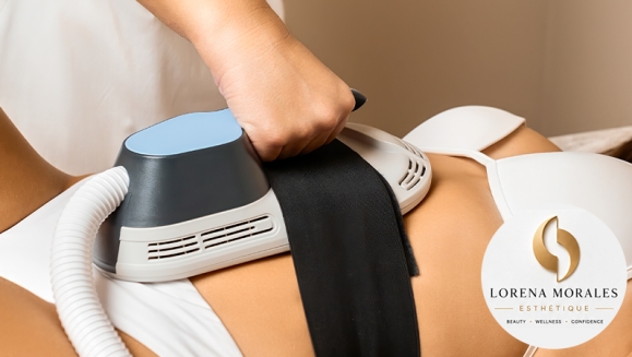[Imagen:¡Abdomen de Acero: Redefine Tu Silueta Sin Cirugía! ¡Paga Q499 en Lugar de Q15,000 Por Circuito de Tratamientos Para Esculpir, Moldear y Marcar tu Abdomen: 3 Exilis Elite + 3 EMscultor + 3 Masajes Drenantes Linfáticos + 3 Ozonoterapias y Más!]