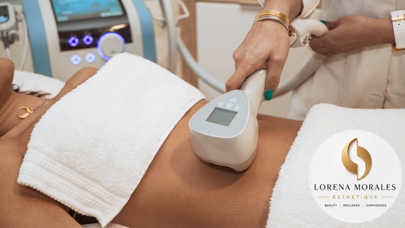 [Imagen:¡Abdomen de Acero: Redefine Tu Silueta Sin Cirugía! ¡Paga Q499 en Lugar de Q15,000 Por Circuito de Tratamientos Para Esculpir, Moldear y Marcar tu Abdomen: 3 Exilis Elite + 3 EMscultor + 3 Masajes Drenantes Linfáticos + 3 Ozonoterapias y Más!]