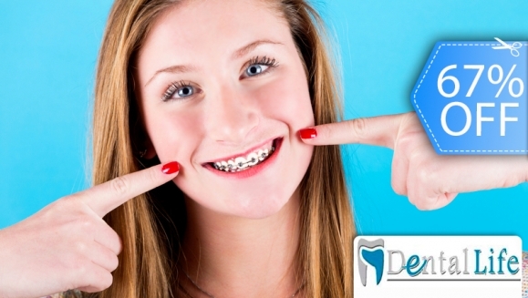 [Imagen:¡Paga Q599 en vez de Q1,800 por Paquete de Ortodoncia que Incluye: Colocación de Brackets Metálicos (Superiores e Inferiores) + Evaluación y Diagnóstico Clínico + Profilaxis Dental + Fotografías y Modelo de Estudio en Dental Life!]