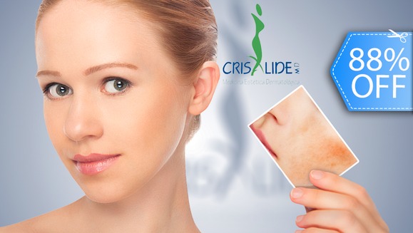 [Imagen:¡Nueva Tecnología de Láser Facial! ¡Paga Q245 en lugar de Q2,100 por 2 Terapias Faciales Láser Diodo (Anti-Acné o Anti-Rosácea) + 2 Mascarillas Personalizadas + 2 Vaporizaciones de Ozono + Hidratación y Protección Solar y Más!]