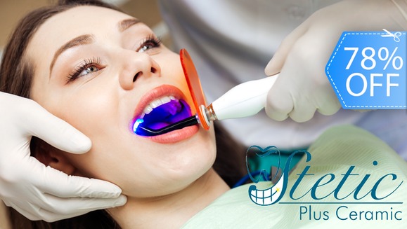 [Imagen:¡Paga Q395 en lugar de Q1,800 por Blanqueamiento Dental Láser + Limpieza Profunda con Ultrasonido + Pulido Dental con Profijet + Aplicación Tópica de Flúor + Evaluación con Cámara Intraoral + Diagnóstico!]