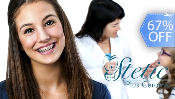 [Imagen:¡Paga Q599 en lugar de Q1,800 por Paquete de Ortodoncia con: Colocación de Brackets Metálicos (Superiores e Inferiores) + Evaluación y Diagnóstico Clínico + Profilaxis Dental + Fotografías y Modelo de Estudio!]