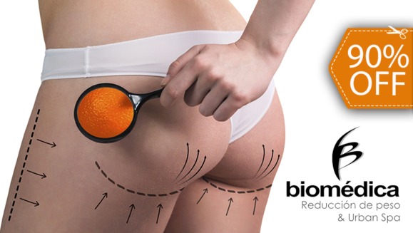 [Imagen:¡Paga $29 en lugar de $300 por 35 Tratamientos Anticelulíticos para Levantamiento y Tonificación de Glúteos con: 6 Nanofrecuencias Brasileñas + 3 Maderoterapias + 3 Masajes Reductivos + 20 Shots Quema Grasa + 3 Térmicos Abdominales!]