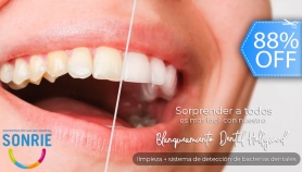 [Imagen:¡Clínicas Sonríe! Blanqueamiento Dental LED, Limpieza Ultrasónica, Diagnóstico y Más.]
