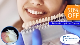 [Imagen:Carilla Dental de Cerómero + Limpieza con Ultrasonido]