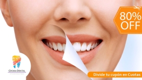 [Image: Blanqueamiento Dental + Limpieza Profunda y Másm]