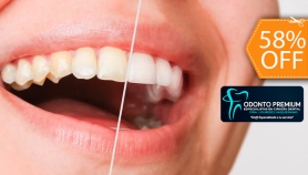 [Image: Blanqueamiento Dental Químico con Luz LED + Limpieza y Pulido Dentalm]