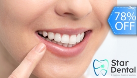 [Image: Blanqueamiento Dental LED, Limpieza con Ultrasonido, Eliminación de Manchas y Más.m]