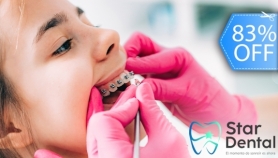 [Image: Colocación de Brackets Metálicos + Limpieza + Fotografías Dentalesm]