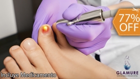 [Image: 3 Sesiones Láser en Uñas con Hongos + Medicamento para la Onicomicosism]