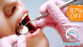 [Image: 3 Rellenos Dentales o 4 Sellantes + Limpieza con Ultrasonido y Másm]