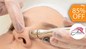 [Image: 2 Sesiones Faciales: Microdermoabrasiones + Altafrecuencias + Extracciones de Puntos Negro y Másm]