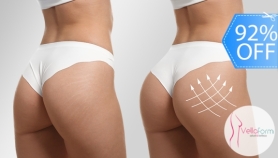 [Image: 85 Tratamientos para Lifting de Glúteos: Lipotransferencia + Maderoterapia + Vacumtransfer y Másm]