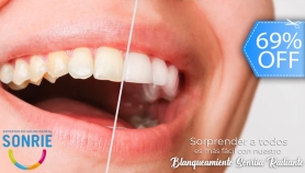 [Image: Blanqueamiento Dental con Cambio de 1 a 2 Tonos +  Diagnóstico + Terapia Desensibilizantem]