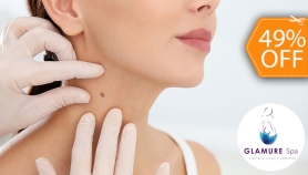 [Image: Electrocauterización de Hasta 20 Verrugasm]