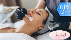 [Image: 1 Peeling Químico a Elección: Antiedad, Despigmentante o Anti-Acné / Purificantem]