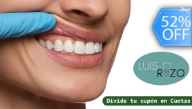 [Image: ¡Luce una SONRISA MÁS ARMÓNICA! Nueva Gingivoplastía con Láser y Más.m]