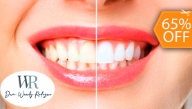 [Image: 2 Aplicaciones de Blanqueamiento Dental con Luz LED + Limpieza Dentalm]