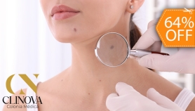[Image: Eliminación de Hasta 15 Verrugas, Acrocordones, Mezquinos o Cabezas de Vena con Plasma Pen o Electrocauterizaciónm]