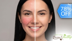 [Image: 2 Sesiones de Tratamiento para Rosácea: Iontoforesis por Oclusión, Fototerapia, Alta Frecuencia y Másm]