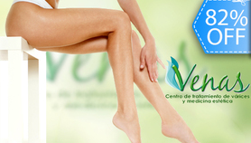 escleroterapia varices espuma